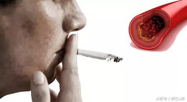 血脂高，臉先知，多食「3物」，多喝3水，少做3事，可防血栓！