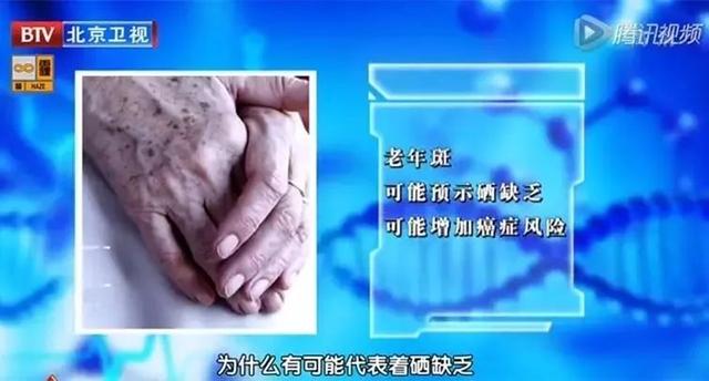 硒是微量元素中的「胰島素」，搭配這8種食物，降糖更有效！