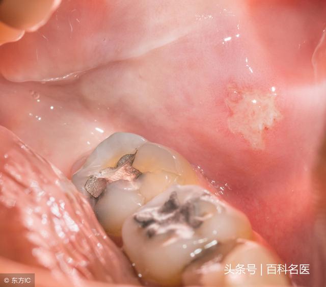你是橫著刷牙還是豎著刷牙？橫著刷會導致這3種疾病，你還不改嗎