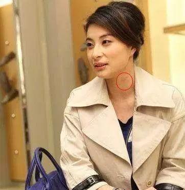 激情過度「留吻痕」的6位女星，而最後一個未婚也有？太尷尬…