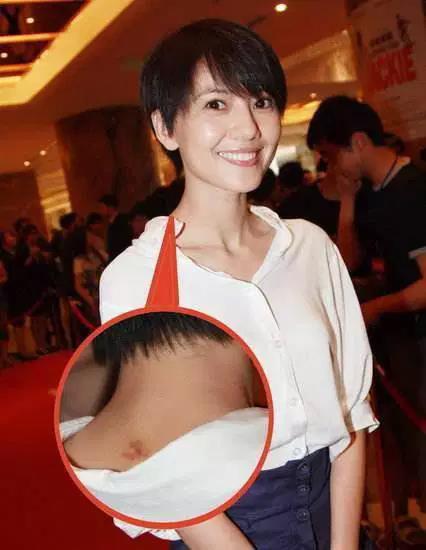 激情過度「留吻痕」的6位女星，而最後一個未婚也有？太尷尬…