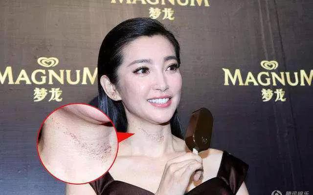 激情過度「留吻痕」的6位女星，而最後一個未婚也有？太尷尬…