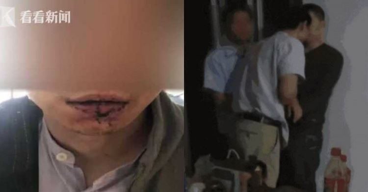 樓上酒醉鄰居太吵！一言不合衝上去「超親密傷害」 網友大笑被閃瞎：在一起啦！