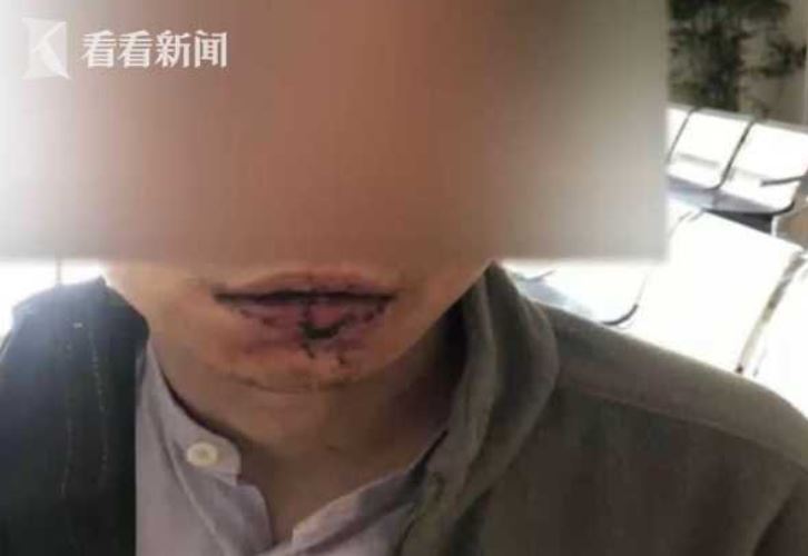 樓上酒醉鄰居太吵！一言不合衝上去「超親密傷害」 網友大笑被閃瞎：在一起啦！