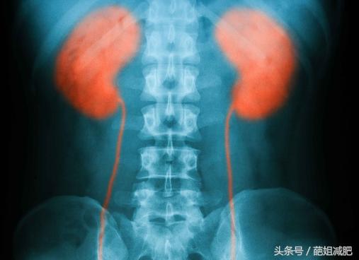 醫生忠告：這5種食物加速腎衰，腎不好別再吃了，當心吃出尿毒症