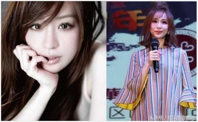 玻尿酸注射過量的女星們，李小璐臉上坑坑窪窪，王心凌直接認不出！