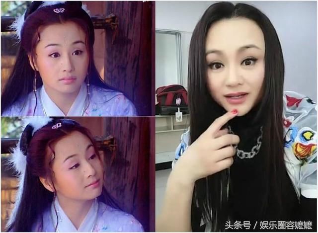 玻尿酸注射過量的女星們，李小璐臉上坑坑窪窪，王心凌直接認不出！