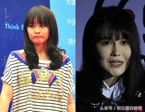 玻尿酸注射過量的女星們，李小璐臉上坑坑窪窪，王心凌直接認不出！