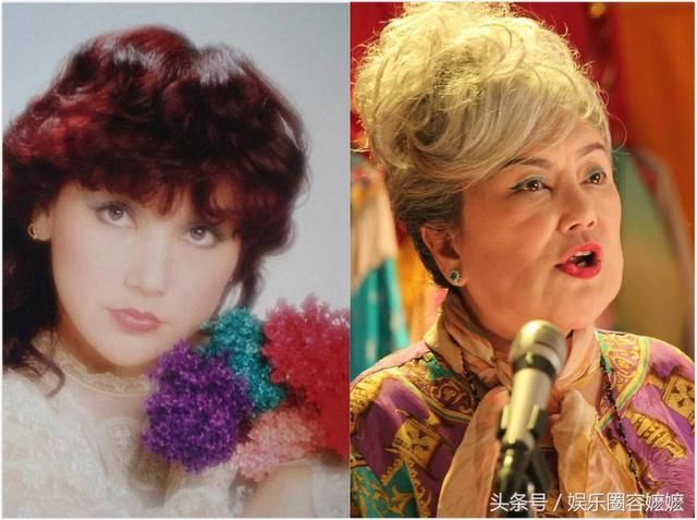 玻尿酸注射過量的女星們，李小璐臉上坑坑窪窪，王心凌直接認不出！