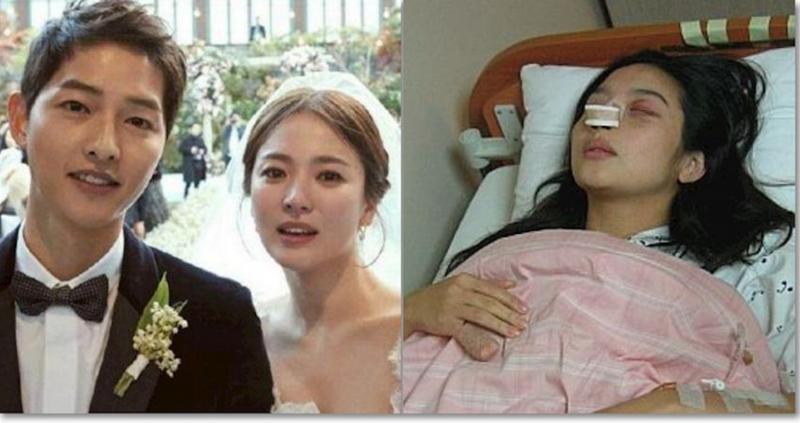 她結婚13天，被丈夫砍掉手指，懷孕被踢肚子，十五周孩子被踢掉!
