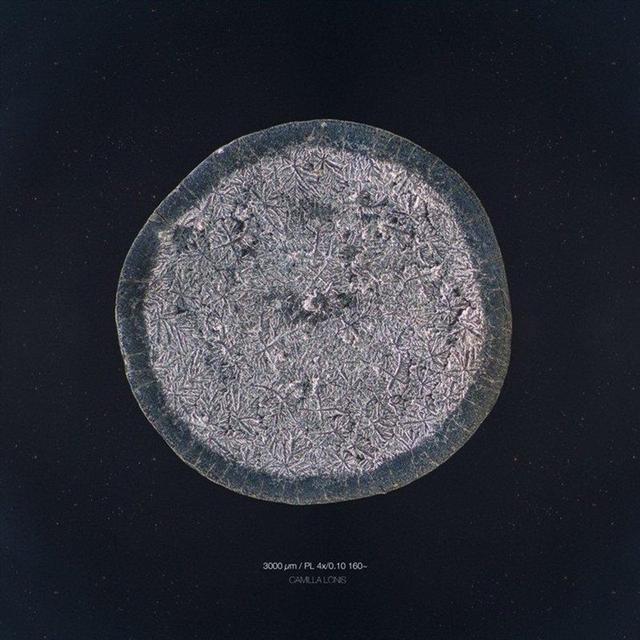 你知道眼淚長什麼樣嗎？攝影師通過實驗告訴你每顆眼淚都是特別的