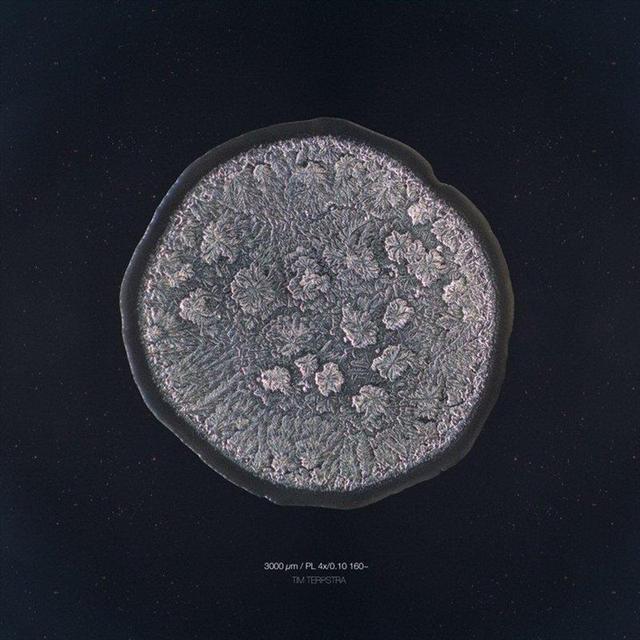 你知道眼淚長什麼樣嗎？攝影師通過實驗告訴你每顆眼淚都是特別的