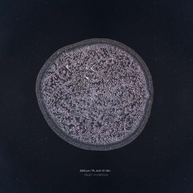 你知道眼淚長什麼樣嗎？攝影師通過實驗告訴你每顆眼淚都是特別的