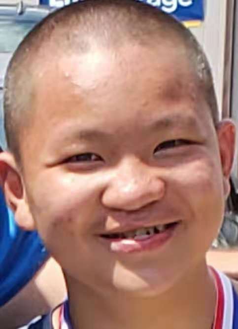 兔唇娃遭遺棄在美國長大，回國尋親生父母：病治好了，看一眼你們