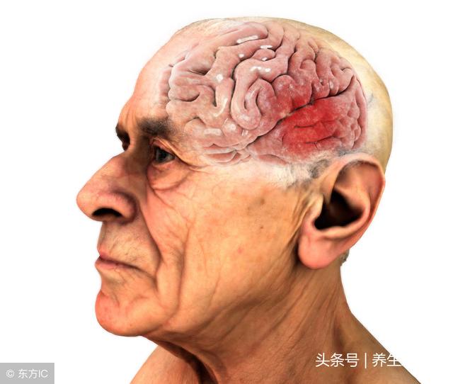 50歲後，想健康，遠離1個字，謹記「三慢」、「四相伴」！