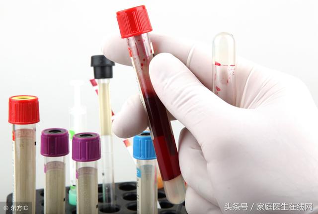 這3個表征在說明一件事，你的血液已經十分「粘稠」了