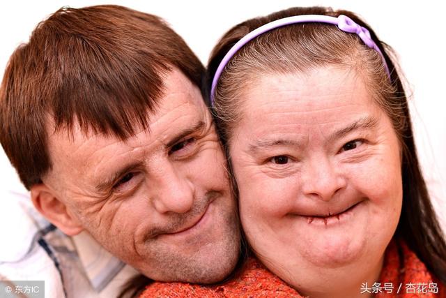 寶寶出生三個月被查出唐氏綜合，婆婆嫌手術貴不讓做，現在婆婆賴我家裡遺傳該怎麼辦？