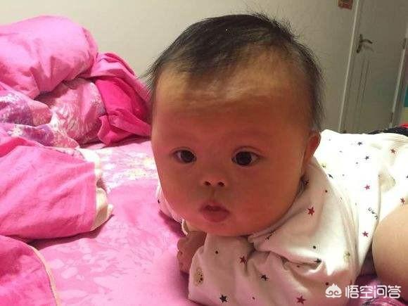寶寶出生三個月被查出唐氏綜合，婆婆嫌手術貴不讓做，現在婆婆賴我家裡遺傳該怎麼辦？