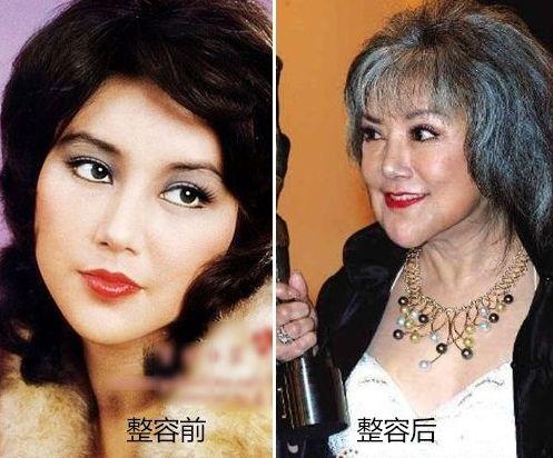盤點整容失敗的女星：金喜善假體掉下來，而她半張臉徹底毀掉了！