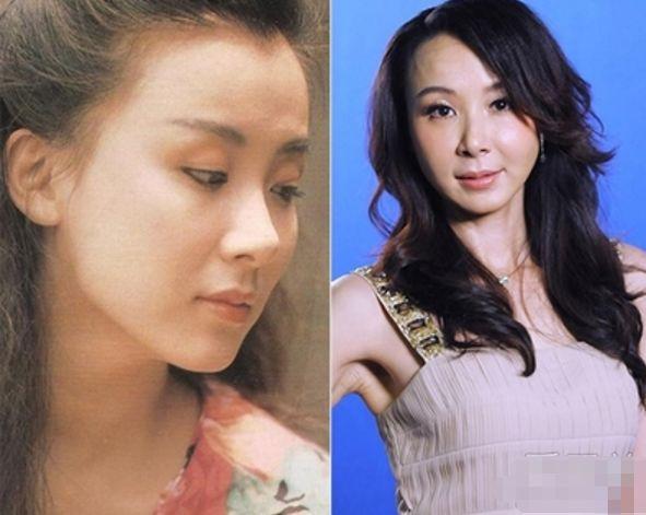 盤點整容失敗的女星：金喜善假體掉下來，而她半張臉徹底毀掉了！