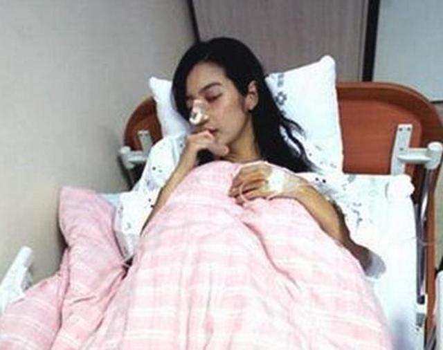 娛樂圈最慘女星，嫁入豪門13天被砍斷手指，懷孕15周被踢流產!