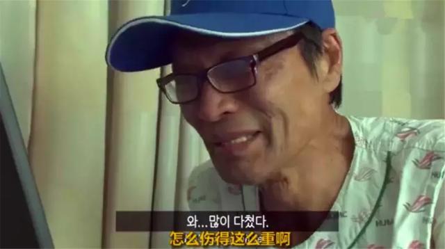 土狗遇火災時堅守家園，被救助後仍不忘舊主，最後終和主人團聚