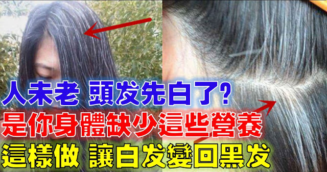 人未老頭髮就白了？原來是你的身體缺少某些營養素！「這麼做」讓白髮變回黑髮哦！！！