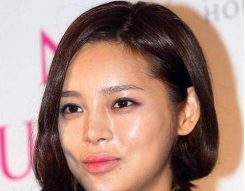 被「整容」毀掉的4位女明星，有一個整成面癱臉，而她不幸去世！
