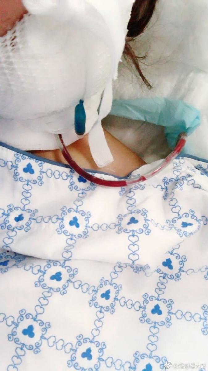正妹主播自爆整容遭醫生「割喉」！無預警消失… 住院照太驚心 休克急送醫院 !
