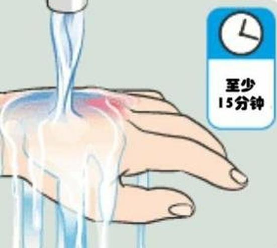 孩子燙傷後，最佳治療時間只有2分鐘，這3步燙傷的急救法，媽媽一定要知道！