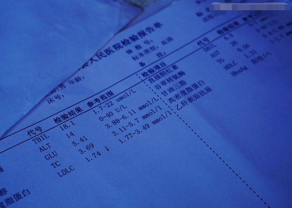 新婚第二天兒子竟死在婚房，兒媳拿回屍檢報告，一家人蒙了