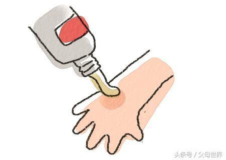 孩子燙傷後，最佳治療時間只有2分鐘，你知道該怎麼做嗎