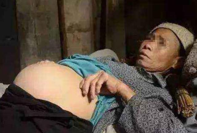 六旬老人意外懷孕，兒女勸其打掉，老人掀開衣服，讓家人跪地哭泣！