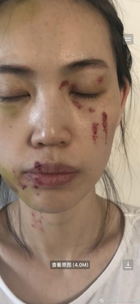 馬蓉爆頭破相照　友誓要王寶強吃牢飯