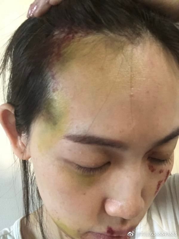 馬蓉爆頭破相照　友誓要王寶強吃牢飯