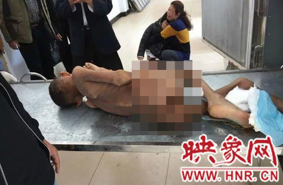 河南信陽一男童走失半年，被發現後已瘦成乾屍 !