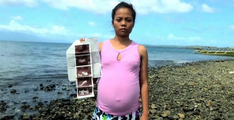 真的懷了魚寶寶嗎？菲律賓少女疑跟海中異形「亂來」致肚子變大，超音波發現「魚寶寶」！