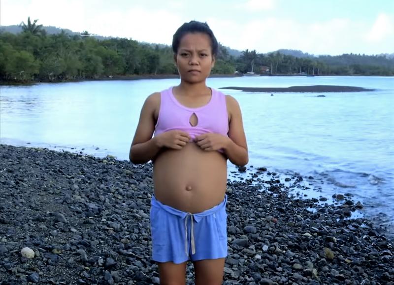 真的懷了魚寶寶嗎？菲律賓少女疑跟海中異形「亂來」致肚子變大，超音波發現「魚寶寶」！