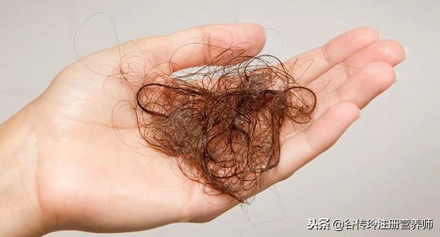頭髮掉的多吃點啥？頭髮與吃你最關心這4個問題