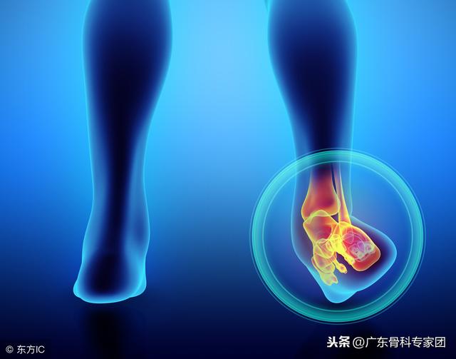扭傷和拉傷是一回事嗎？處理方法做不對後果都很糟
