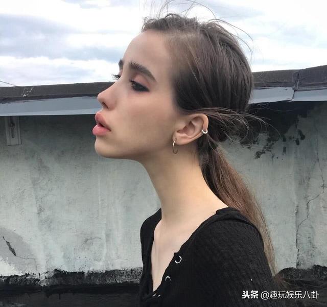 俄羅斯女孩減肥至30kg，大腿比平常人胳膊還細，風大都不敢出門 