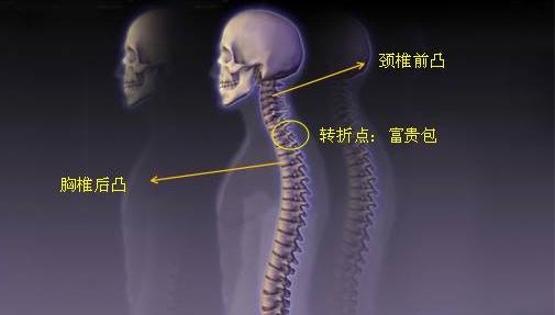 脖子上的【富貴包】越長越大？教你3個小動作【自我治療】，富貴包慢慢變小！
