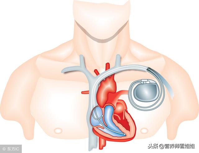不想心臟「早衰」，堅持「三多三少」，常按四處，強心更健康！