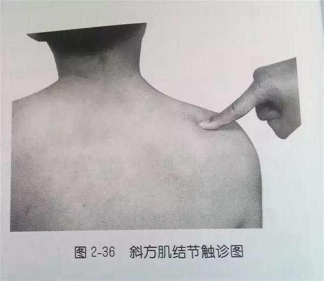 肩部疼痛圖解（很珍貴）