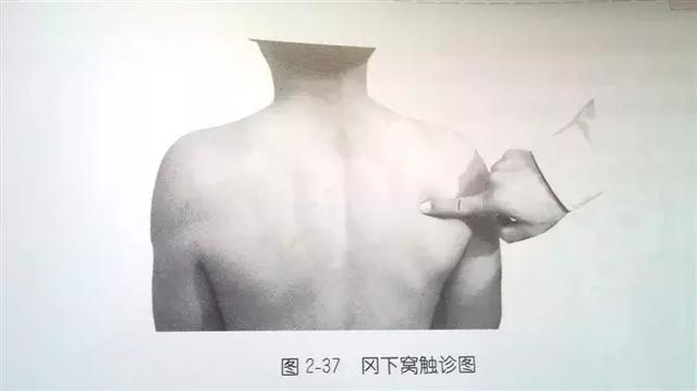 肩部疼痛圖解（很珍貴）