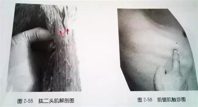肩部疼痛圖解（很珍貴）