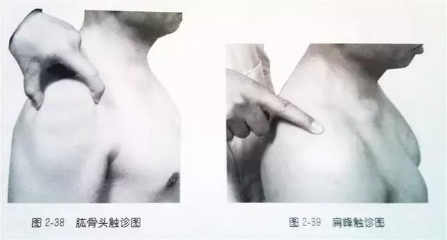 肩部疼痛圖解（很珍貴）
