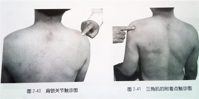 肩部疼痛圖解（很珍貴）