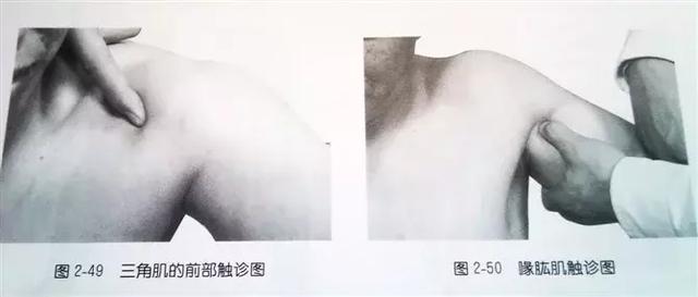 肩部疼痛圖解（很珍貴）