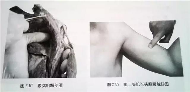 肩部疼痛圖解（很珍貴）
